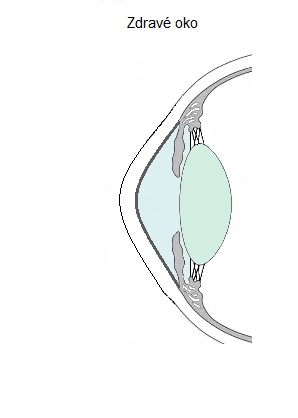 zdravá rohovka