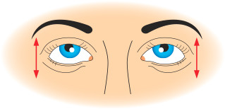 oční cvičení svislým pohybem