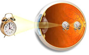 oko - krátkozrakost